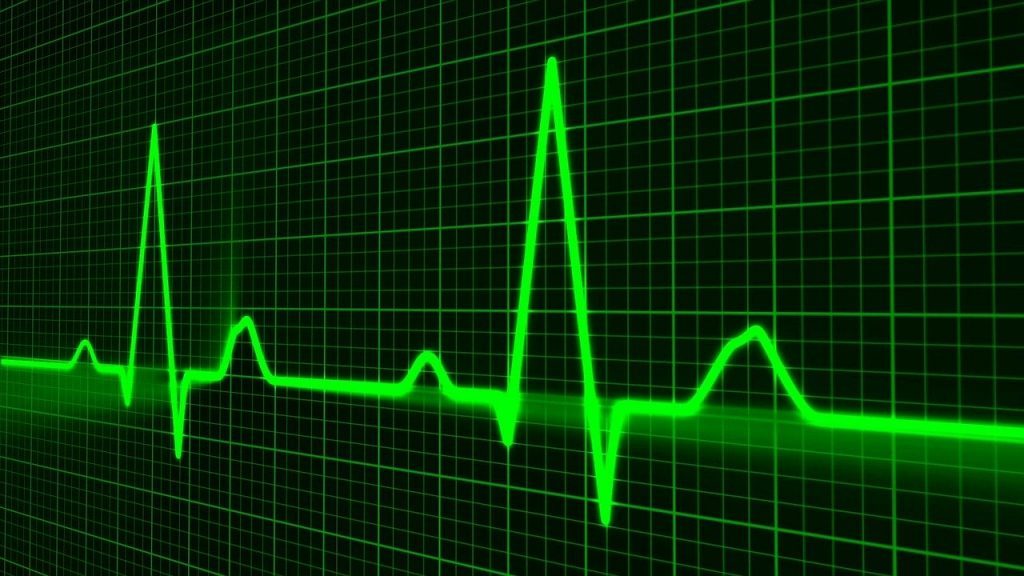 pulse trace 163708 1280 Moncloa