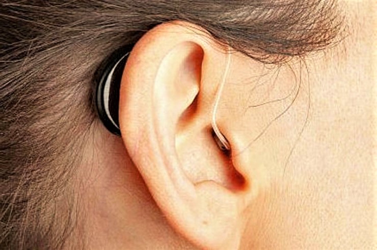 aparatos auditivos