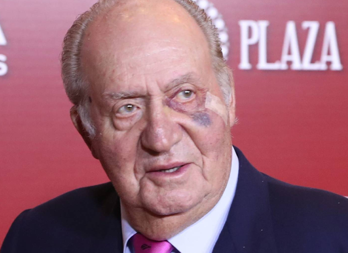 LOS HEMATOMAS EN EL OJO DE DON JUAN CARLOS, ALGO HABITUAL EN LA CASA REAL
