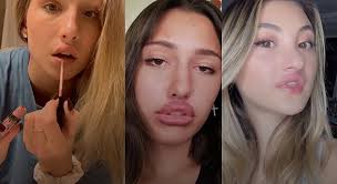 Alto peligro: Los retos más populares y de alto riesgo de TikTok 3 Moncloa Super Glue Lips Challenge