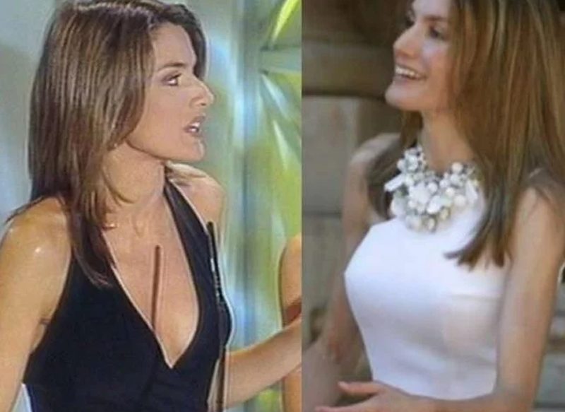LA MASTOPEXIA DE LA REINA LETIZIA