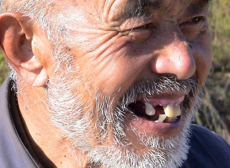 SUEÑO CON QUE SE CAEN LOS DIENTES SIN DOLOR