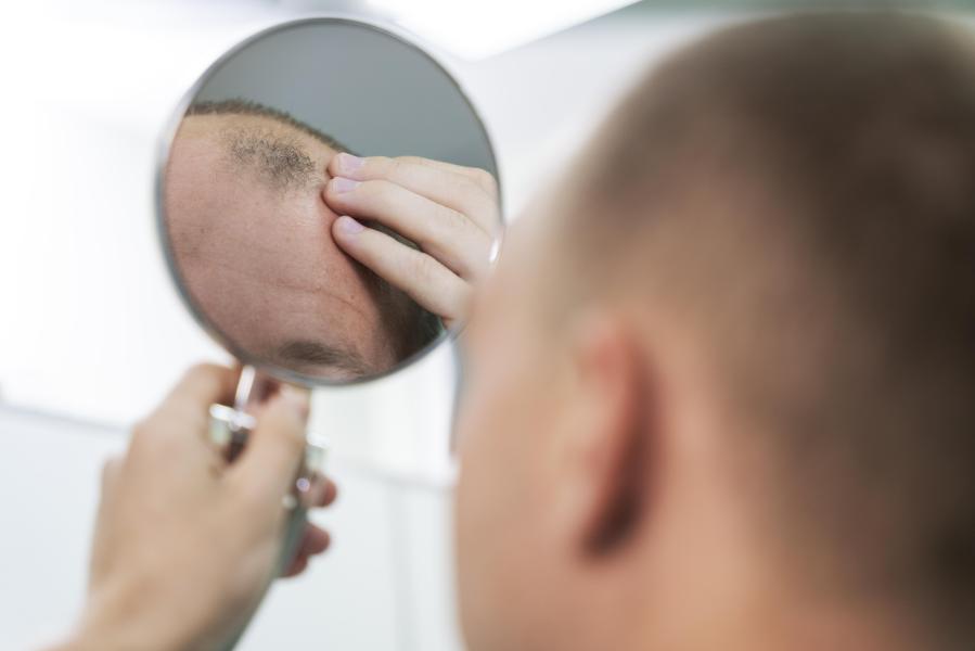 Esta conducta diaria produce caída de cabello