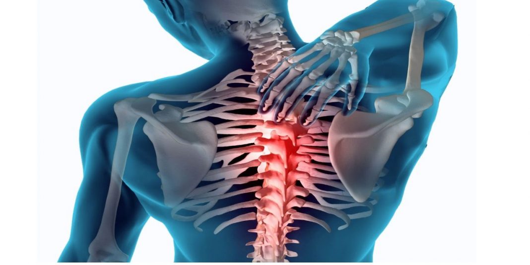 Un complemento ideal