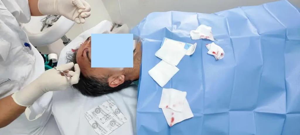 Marlaska guarda silencio ante una nueva agresión a la Guardia Civil 1 Moncloa Guardia Civil Moncloa