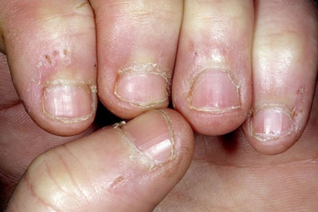 uñas
