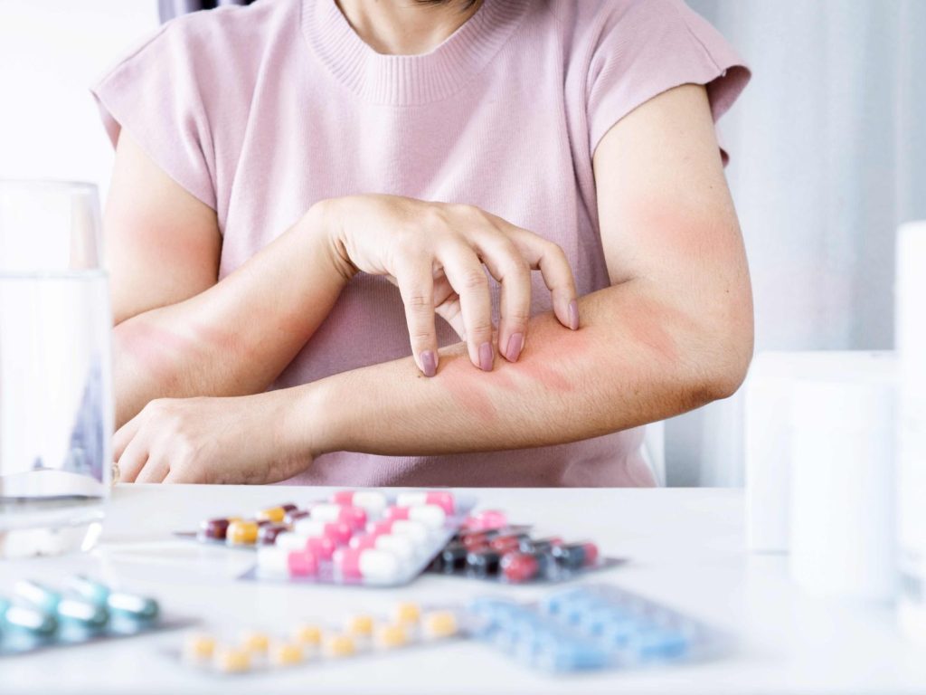 Alerta OCU: Investigación urgente sobre efectos del Ibuprofeno en autoconsumo 1 Moncloa ibuprofeno