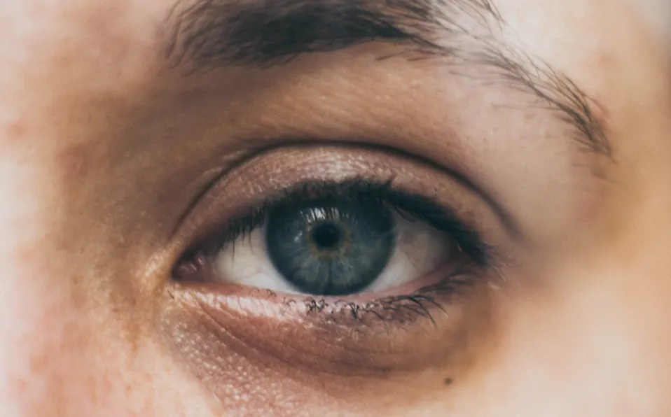 ojeras ojeras