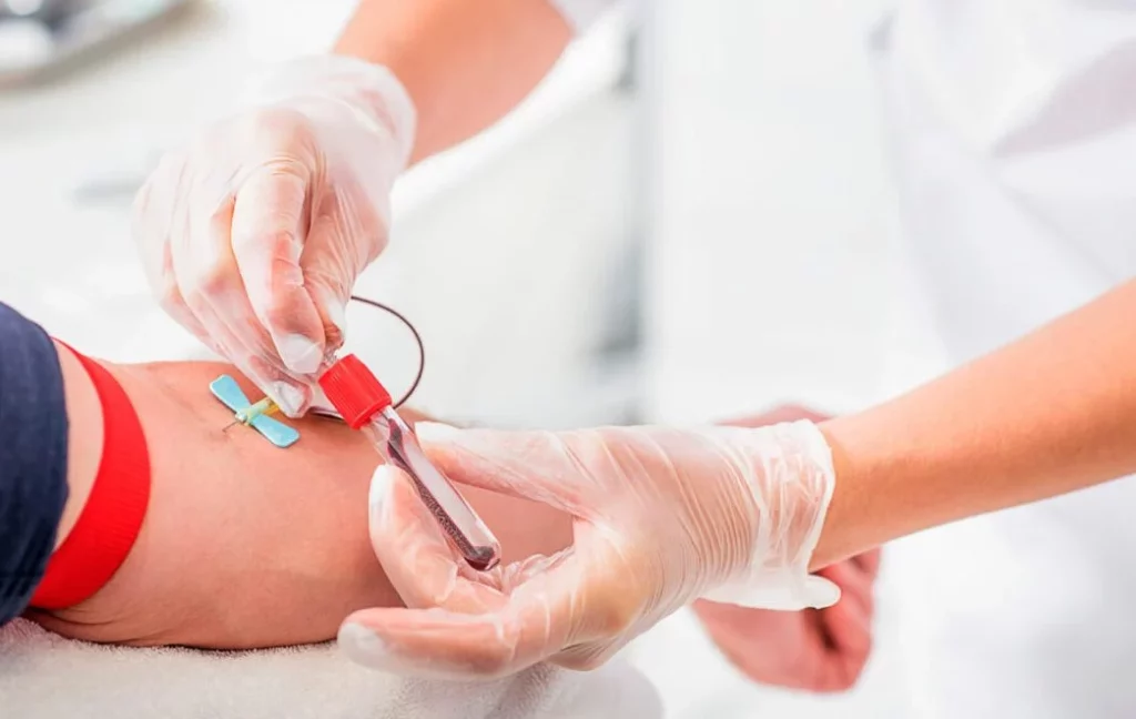 Si presentas alguno de estos síntomas es momento de hacerte un examen de próstata 2 Moncloa ¿Que se debe hacer para realizarse una PSA?