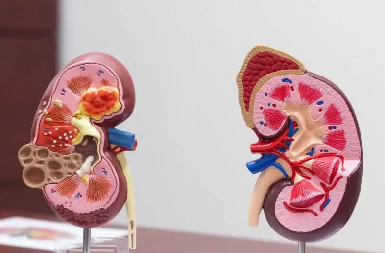 Elimina el dolor de riñones con 3 ingredientes 1 Moncloa ¿Cuáles son los beneficios de estos ingredientes?