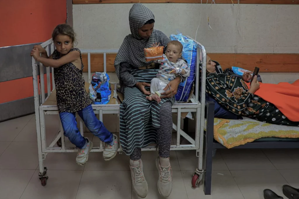 EuropaPress 6005518 gaza june 2024 palestinian child suffering from malnutrition 3rd is seen Moncloa