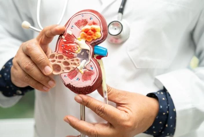 Cuidado con los alisados de cabello: los peligros poco conocidos que ponen en riesgo tu salud 1 Moncloa Los alisados de cabello pueden generar daño renal y cáncer