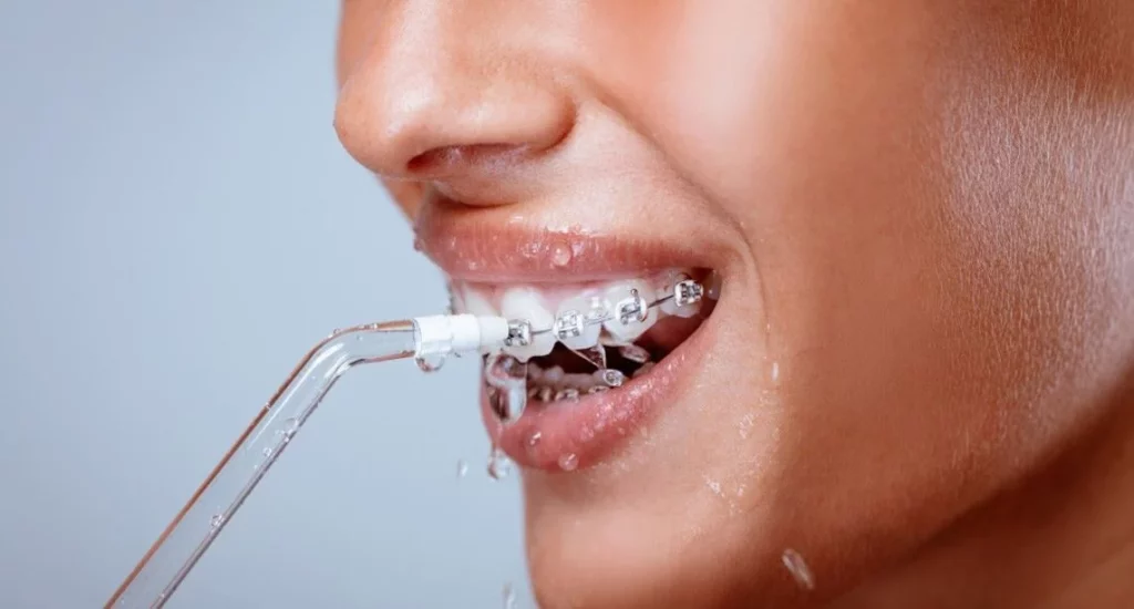 El producto que revoluciona la higiene dental: mejor que el hilo dental 1 Moncloa ¿Por qué los especialistas recomiendan el uso de irrigadores para la higiene dental?