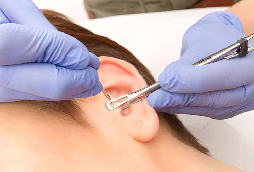 Qué es el "daith piercing": la solución natural para migrañas sin medicinas 1 Moncloa ¿Es seguro usar el daith piercing para acabar con las migrañas?
