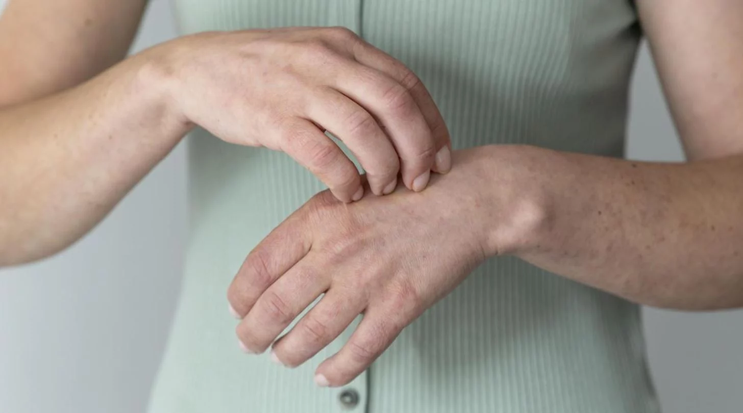 Consigue el spray repelente de mosquitos más vendido de Amazon para tus vacaciones hoy a precio de regalo