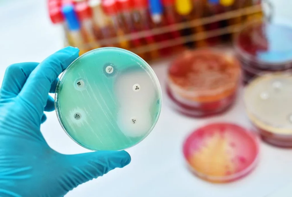 Estrategias efectivas para evitar la resistencia a los antibióticos 1 Moncloa ¿Cómo evitamos la resistencia a los antibióticos?