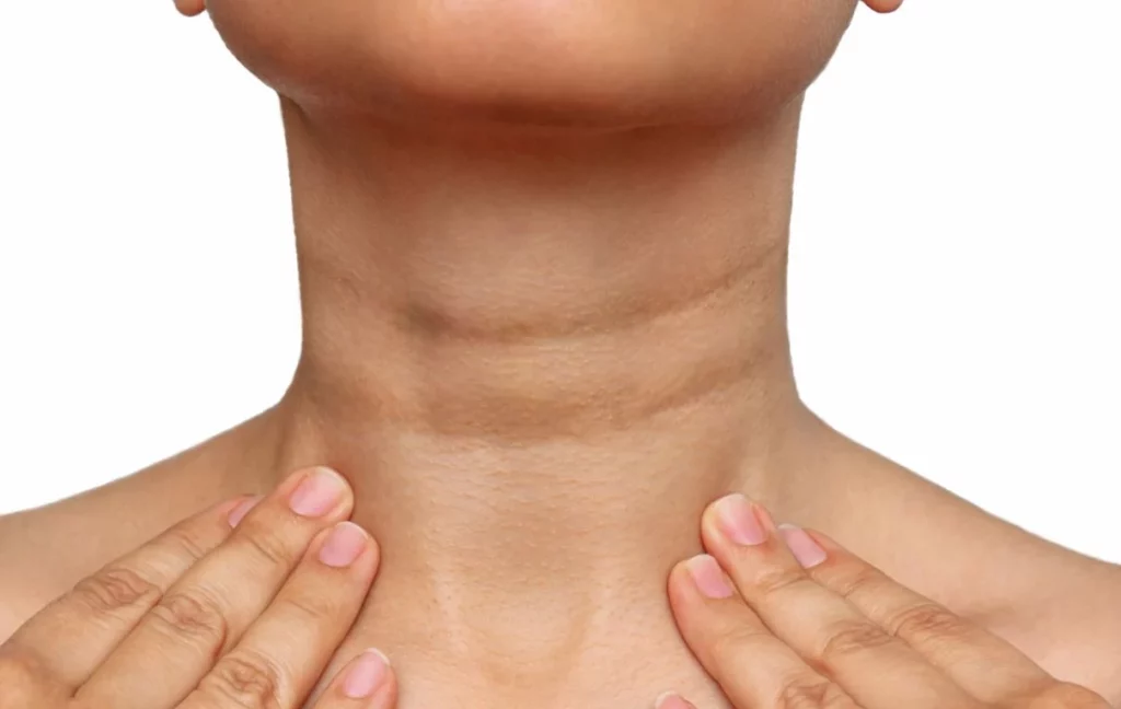 Cómo un simple cambio en tu piel podría indicar diabetes tipo 2 2 Moncloa Otras condiciones que pueden generar estas manchas en la piel