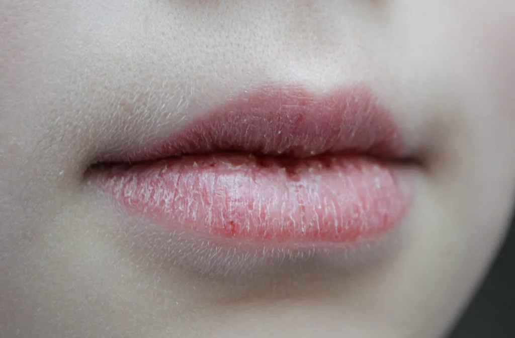 Si amaneces con la boca seca, tu cuerpo te está enviando un mensaje 1 Moncloa DESHIDRATACIÓN: UNA CAUSA FRECUENTE DE BOCA SECA