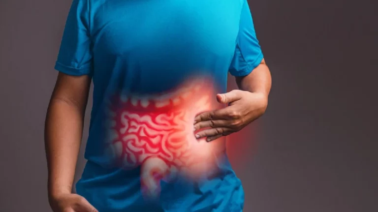 Preparación intestinal eficaz antes de procedimientos médicos