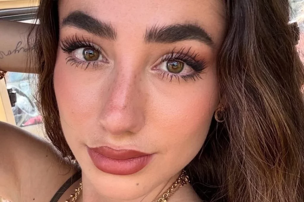 Desvelamos rutina anti-acné de Lola Lolita, paso a paso 1 Moncloa Consejos para cuidar tu piel como lo hace Lola Lolita