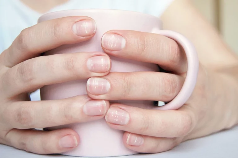 Si ves esta línea en tus uñas, acude al médico hoy mismo