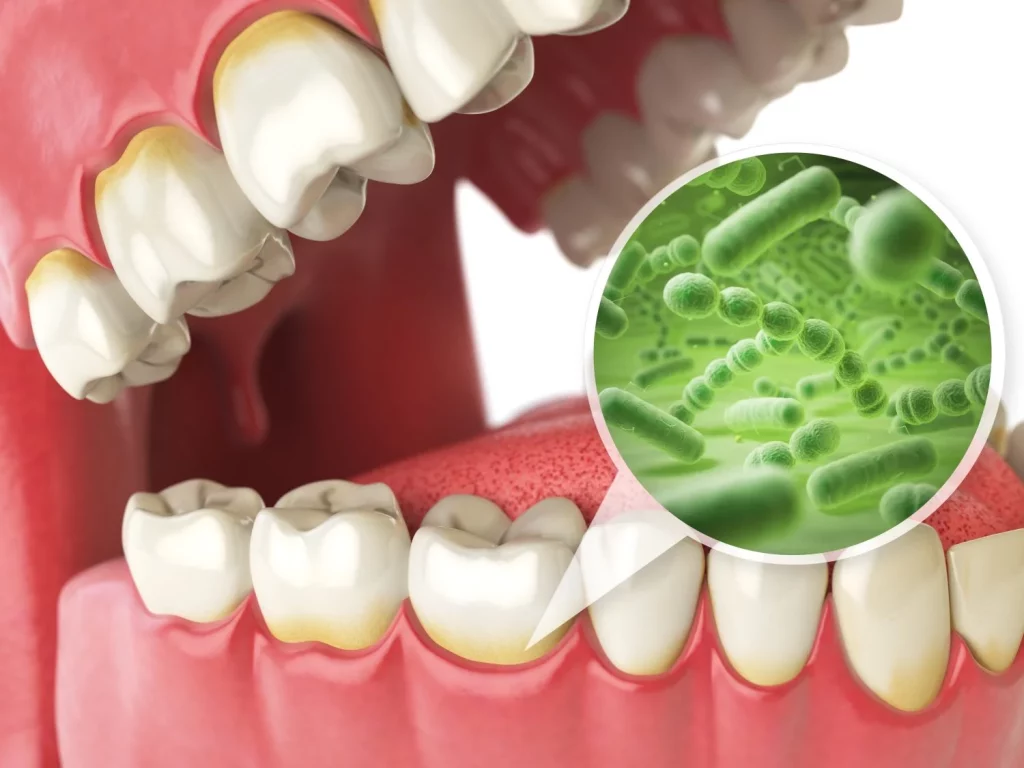 Placa bacteriana freepik 0 Moncloa