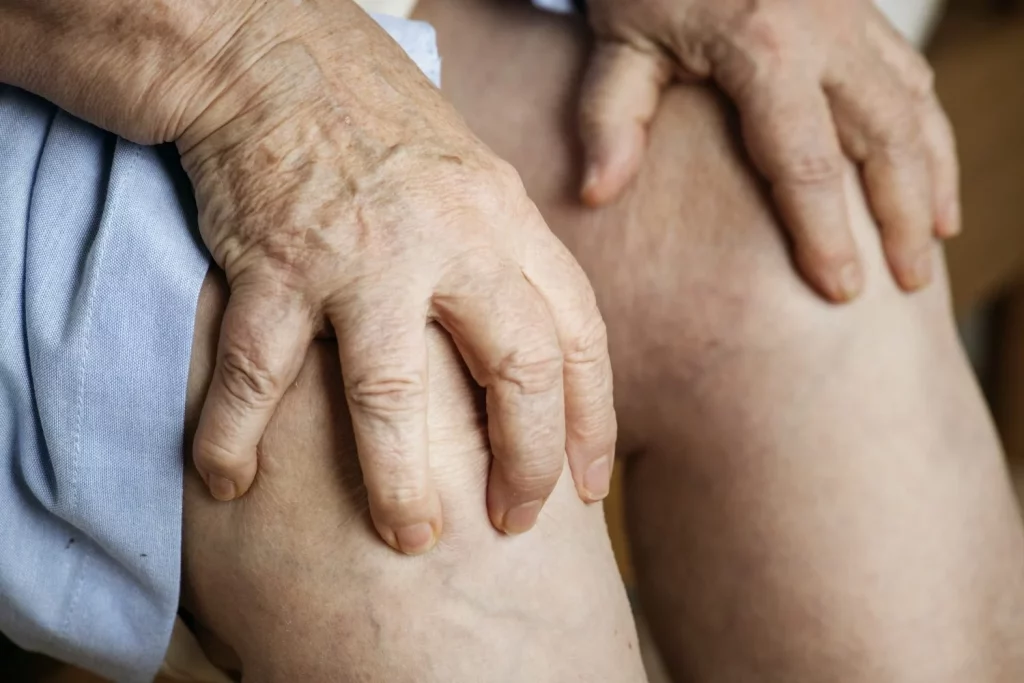 Ese picor nocturno en las piernas no es sequedad, tu cuerpo te avisa de algo más serio 31 Moncloa PROBLEMAS CIRCULATORIOS: CUANDO LA SANGRE NO FLUYE CORRECTAMENTE