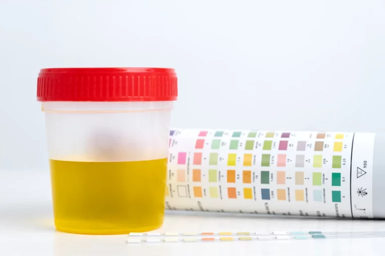 Si tu orina tiene este color, deberías beber agua urgentemente pero si tiene este otro, consulta a un médico