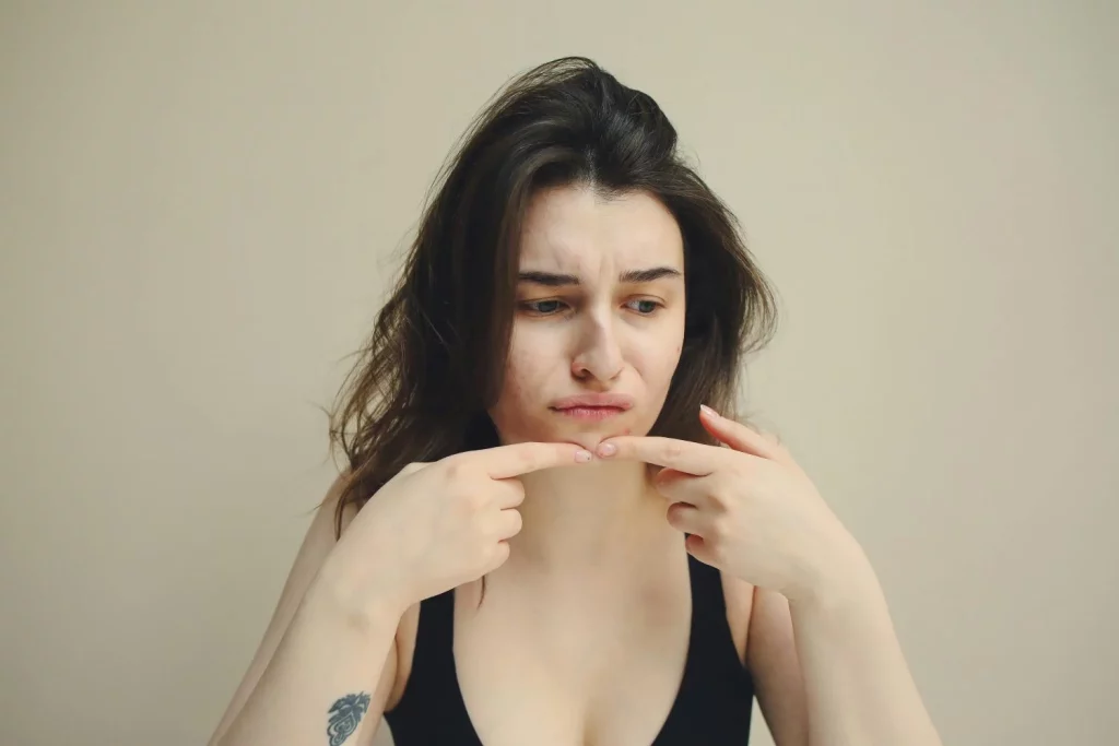 Si tu acné esconde esto, tu salud podría estar en riesgo y no es una simple cuestión estética 22 Moncloa Una buena rutina de cuidado facial es clave