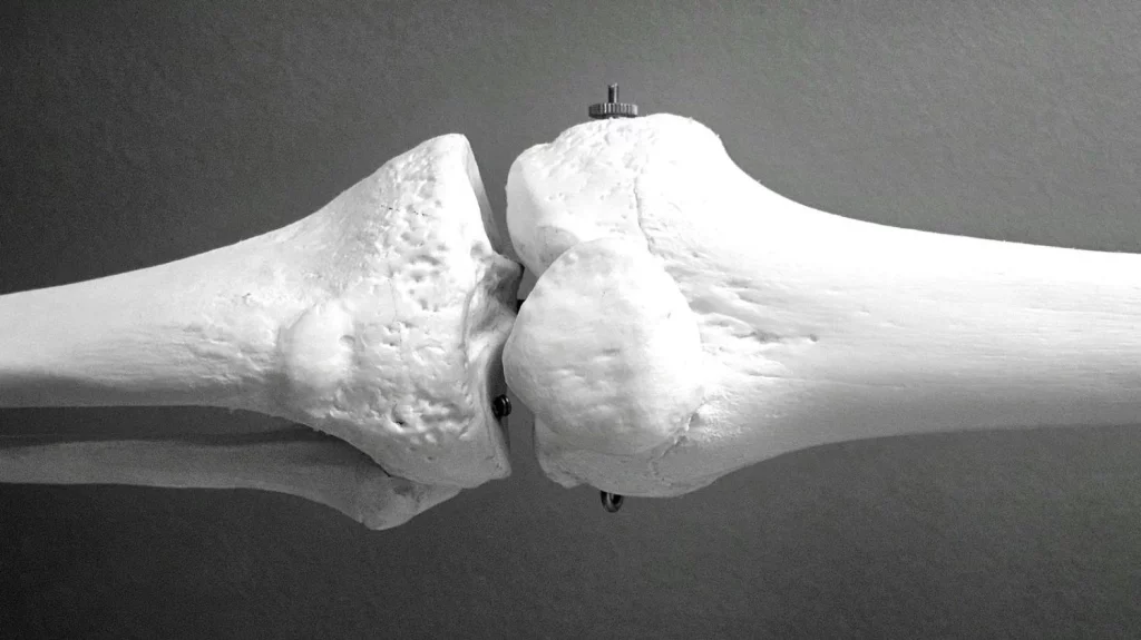 Prevenir la osteoporosis puede estar en tus manos
