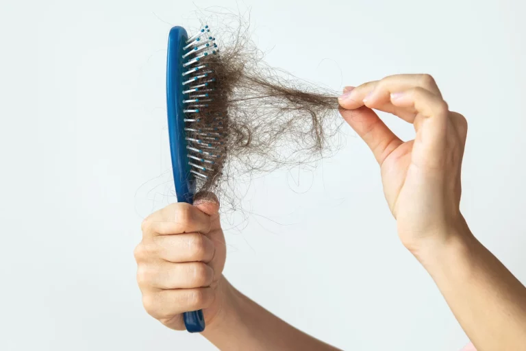 Esta es la vitamina que el 60% de españoles tiene baja y provoca caída del cabello y no es el hierro