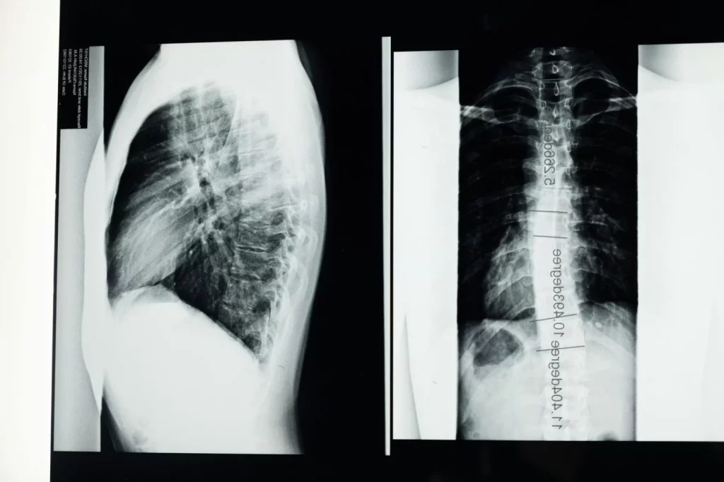 El yoga muestra resultados muy parecidos frente a la fisioterapia