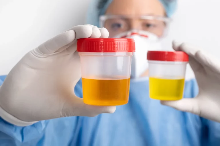 Dr. Ernesto Revuela (59), oncólogo: ‘Este es el primer síntoma del cáncer de páncreas que el 90% de la gente ignora, y después ya es tarde’