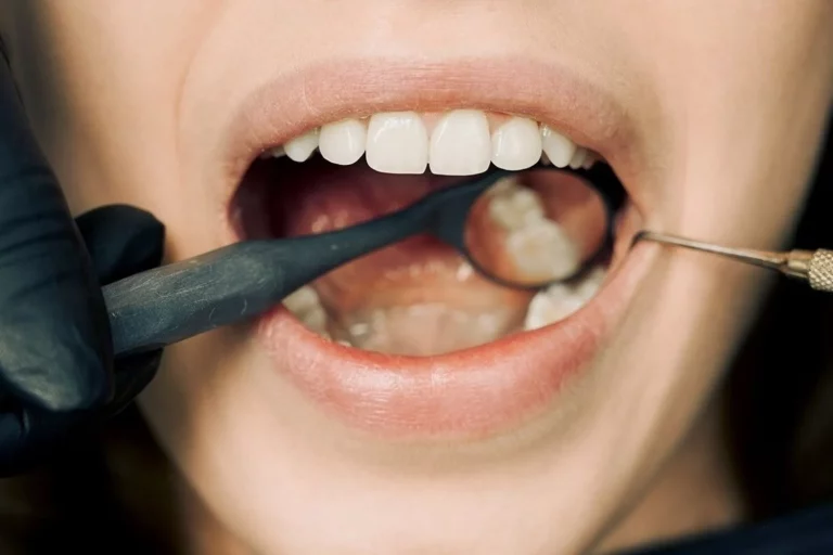 Incluye estos 8 nutrientes a tu dieta o prepárate para perder tus dientes antes de los 40 años
