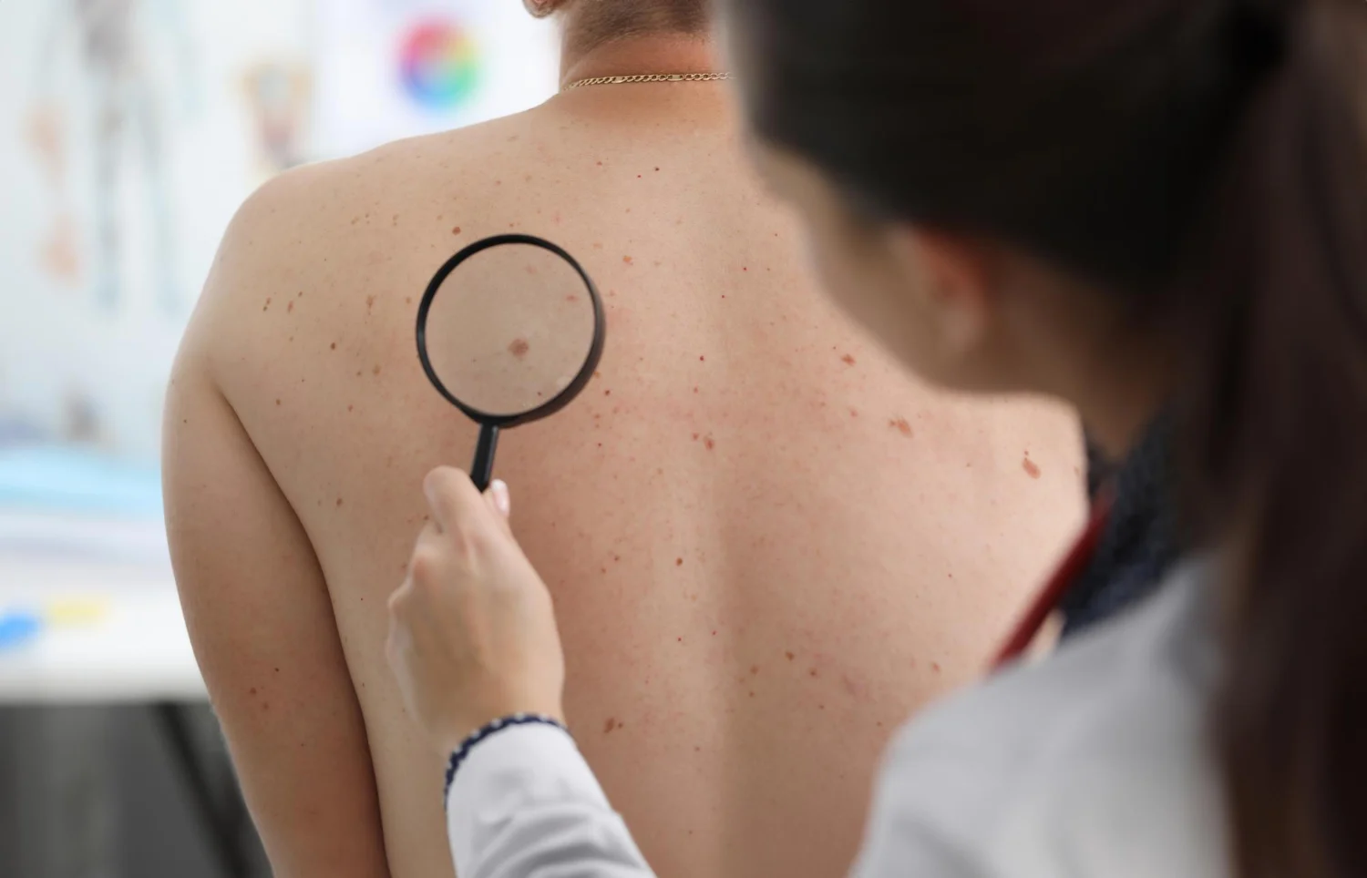 Dra. Eva Soler (51), dermatóloga: 