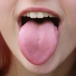Dr. Martín Soria (45), endocrinólogo: «Si se te duerme la lengua después de desayunar, alerta: tu páncreas puede estar a punto de causar un coma diabético irreversible»