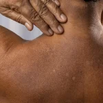 “Así te va avisando la diabetes un año antes y casi nadie está haciendo nada”, alerta la Dra. Mónica Torres (52), endocrina