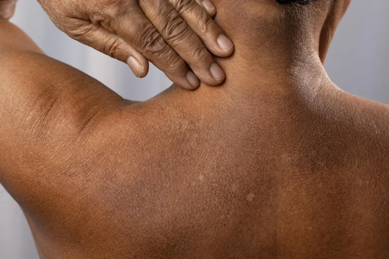 “Así te va avisando la diabetes un año antes y casi nadie está haciendo nada”, alerta la Dra. Mónica Torres (52), endocrina