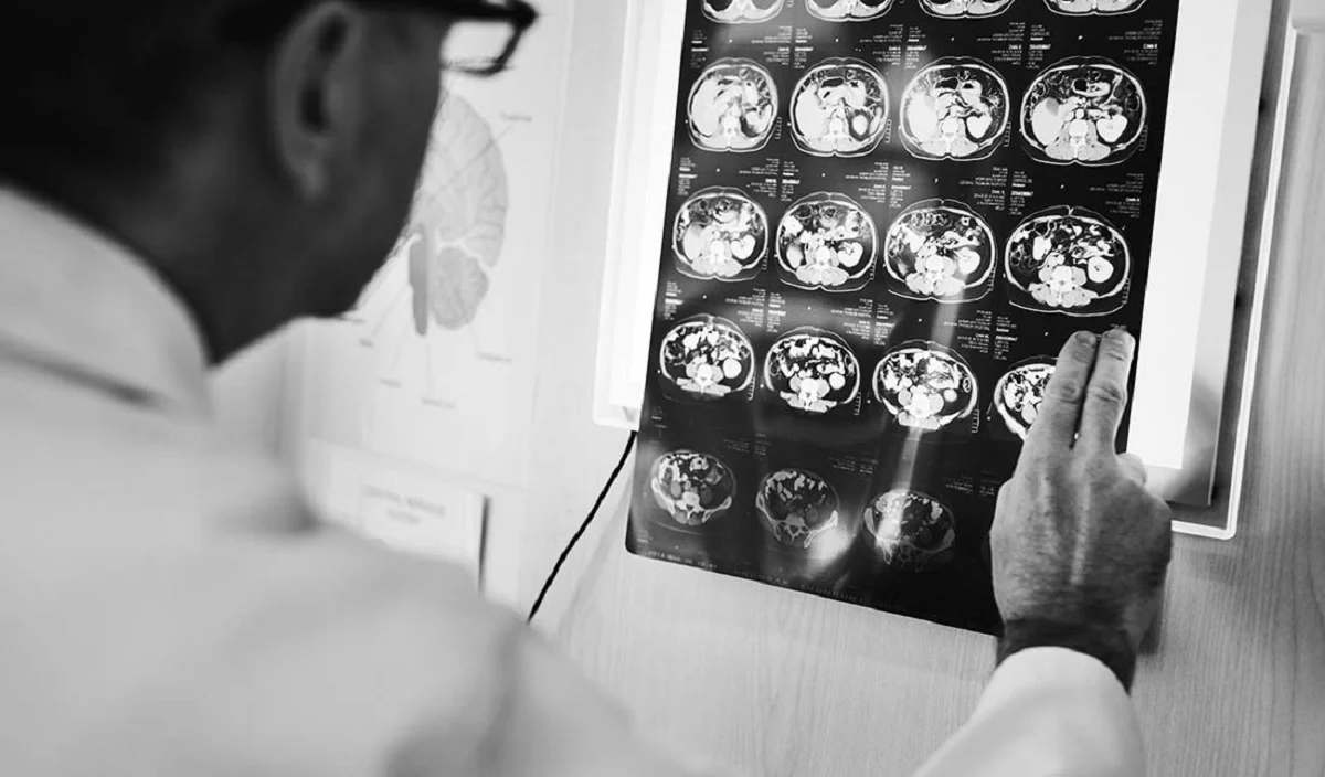 CADPET impulsa el diagnóstico precoz del cáncer con tecnología PET-TAC de última generación CADPET impulsa el diagnóstico precoz del cáncer con tecnología PET-TAC de última generación