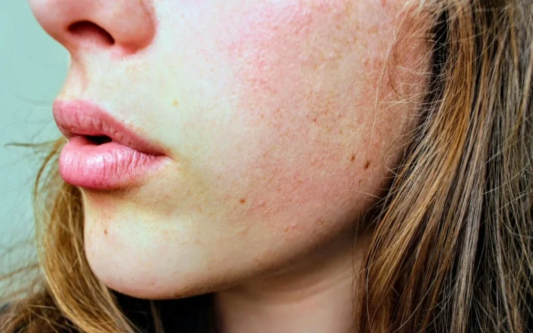 Termina con la maldita Halitosis y deja de pasar vergüenza