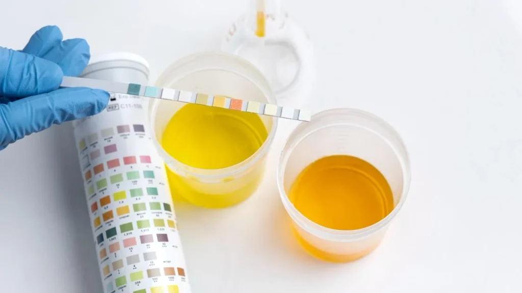 Cómo identificar la deshidratación con una señal tan simple como el color de la orina