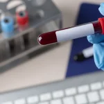 Ni cada 6 meses, ni cada año, ¿Sabes cuándo toca tu próximo análisis de sangre? Esto es lo que dicen los médicos