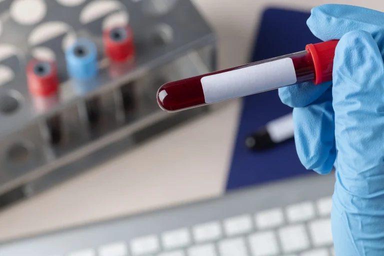 Ni cada 6 meses, ni cada año, ¿Sabes cuándo toca tu próximo análisis de sangre? Esto es lo que dicen los médicos