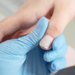 «Examina tus uñas ahora», oncólogo advierte este cambio en ellas predice cáncer de colon 2 años antes