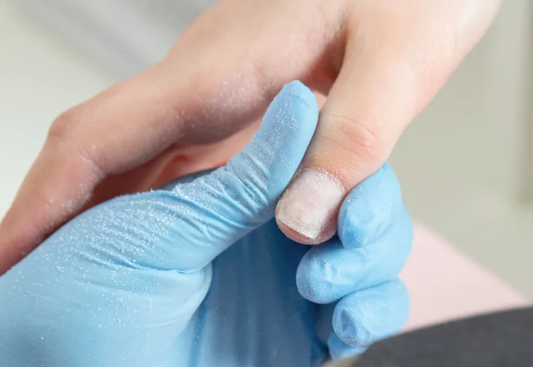 «Examina tus uñas ahora», oncólogo advierte este cambio en ellas predice cáncer de colon 2 años antes