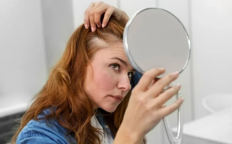 Dr. Antonio Hernández, nutricionista, da soluciones naturales contra la caída del pelo