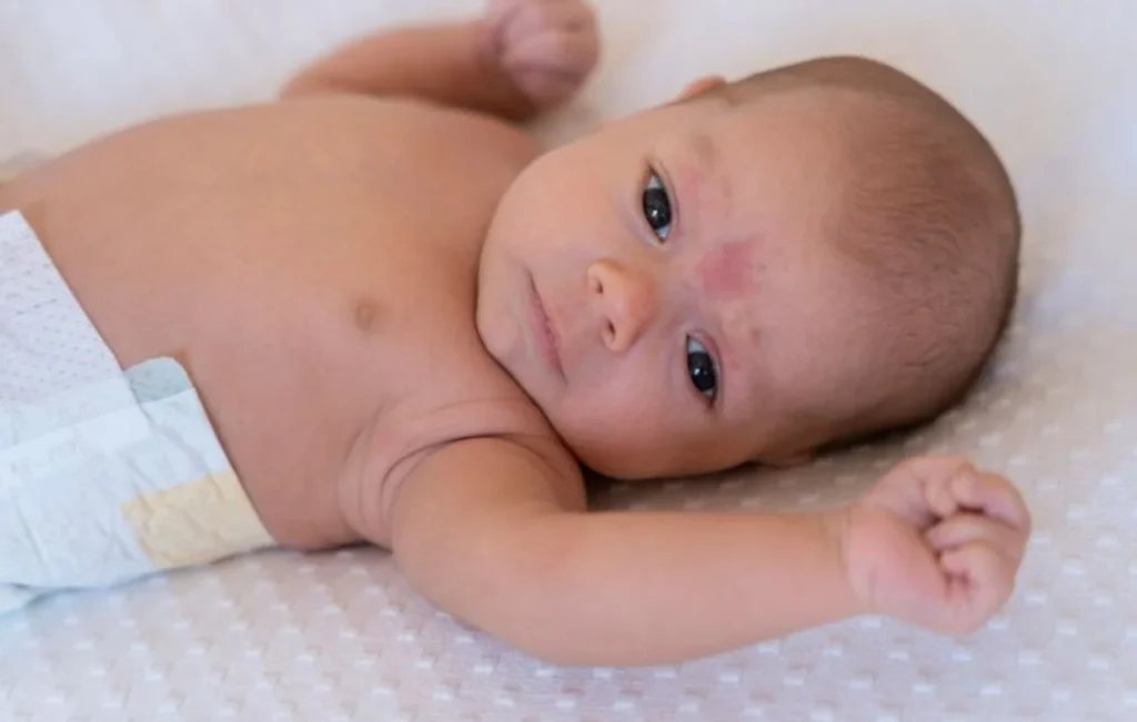 Cuando las alergias no aparecen en la piel se muestran de otras formas