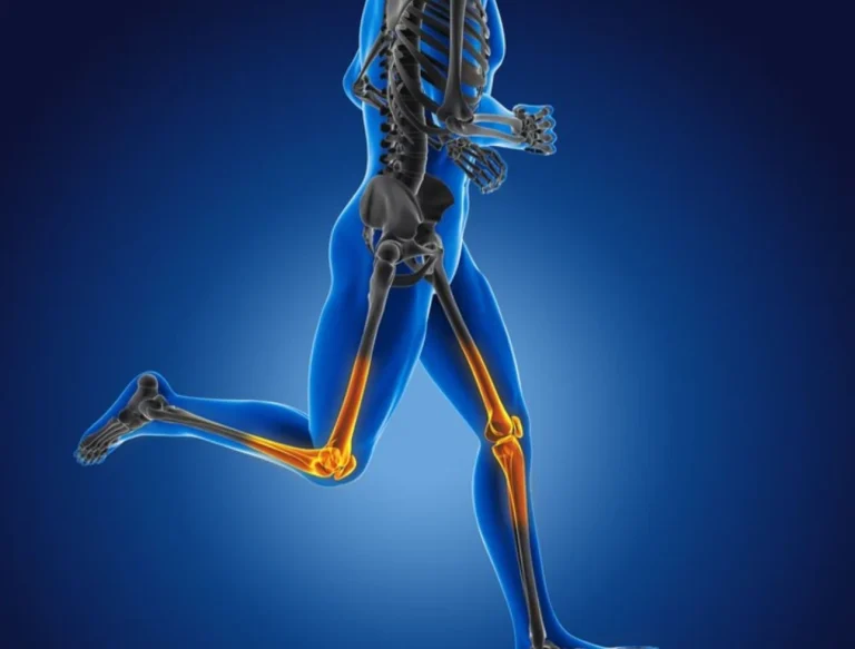 Los huesos podrían verse afectados por un hábito matutino que muchos tienen